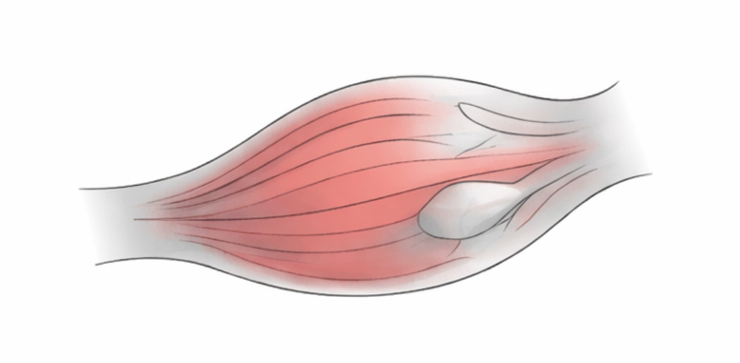 Muscle-Illustration